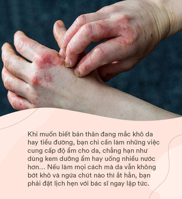 Bệnh tiểu đường đang âm thầm phát triển nếu bạn có một trong 6 dấu hiệu này trên da: Đa phần hệt như viêm da khiến nhiều người chủ quan-3