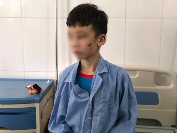 Lạnh người trước lời khai của nữ chủ quán bánh xèo bạo hành nhân viên ở Bắc Ninh: Em lấy cây cọ chà nhà vệ sinh đánh, chọc vô mắt-2