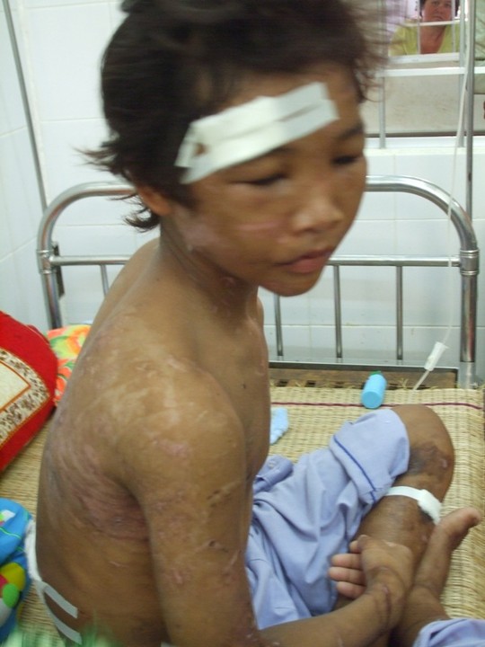 Cậu bé Cà Mau từng bị tra tấn như thời trung cổ ngày ấy: Cú trượt dài ở tuổi mới lớn, các bậc cha mẹ cần rút kinh nghiệm dạy con-1