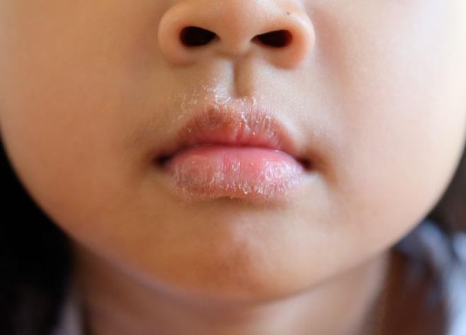 Những dấu hiệu cảnh báo bệnh nguy hiểm bạn cần chú ý-1