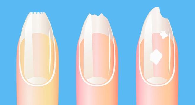 Những dấu hiệu cảnh báo bệnh nguy hiểm bạn cần chú ý-3