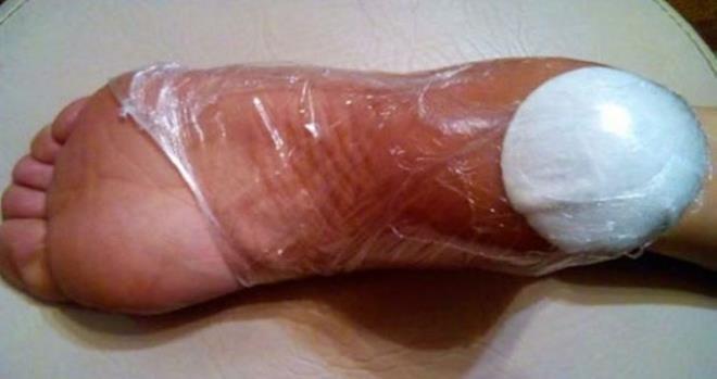 Những dấu hiệu cảnh báo bệnh nguy hiểm bạn cần chú ý-5