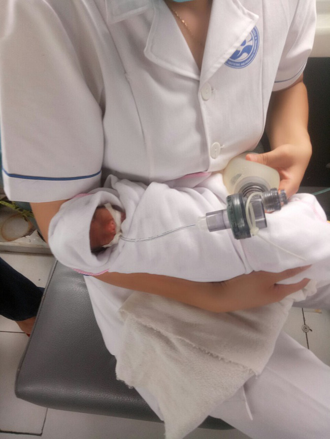 Hành trình nuôi sống kỳ diệu của em bé sinh ra với cân nặng nhỏ nhất Việt Nam-1