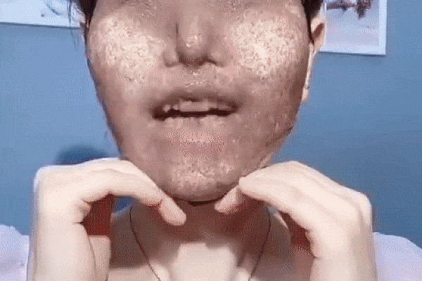 Bác sĩ khuyến cáo: Nàng da dầu cần tránh 4 sản phẩm skincare kẻo mùa Đông da cũng bóng nhẫy chẳng khác mùa Hè-4