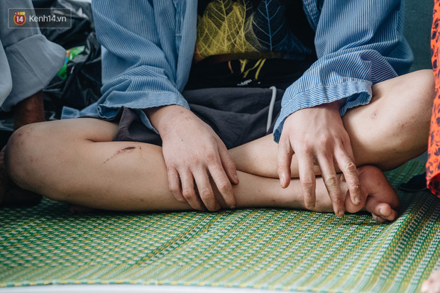 Người thân xót xa khi gặp lại cậu bé 15 tuổi bị chủ quán bánh xèo bạo hành, hy vọng cháu sớm về quê tiếp tục việc học-6