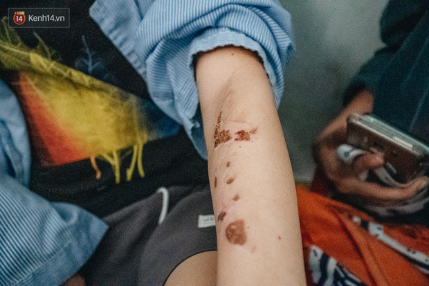 Người thân xót xa khi gặp lại cậu bé 15 tuổi bị chủ quán bánh xèo bạo hành, hy vọng cháu sớm về quê tiếp tục việc học-7