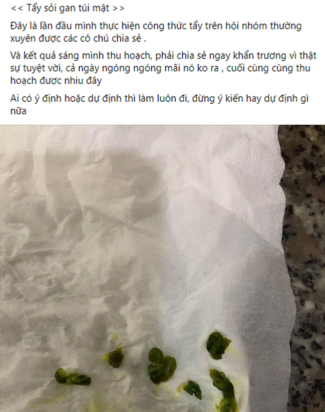 Xổ ra cả đống sỏi gan, sỏi mật nhờ uống dầu ôliu, dầu dừa: Sự thật kinh hoàng phía sau mới là điều bạn cần biết về trào lưu detox đang làm mưa gió trên MXH-1