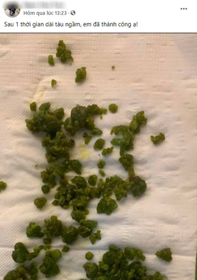 Xổ ra cả đống sỏi gan, sỏi mật nhờ uống dầu ôliu, dầu dừa: Sự thật kinh hoàng phía sau mới là điều bạn cần biết về trào lưu detox đang làm mưa gió trên MXH-2