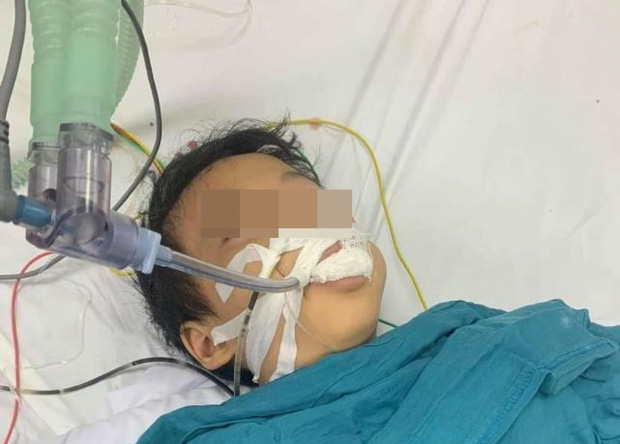 Học sinh lớp 1 ăn nhầm thuốc diệt chuột hình viên kẹo-1