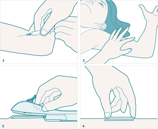 Cấy que tránh thai - tưởng không đau, hóa ra vẫn đau không tưởng-2