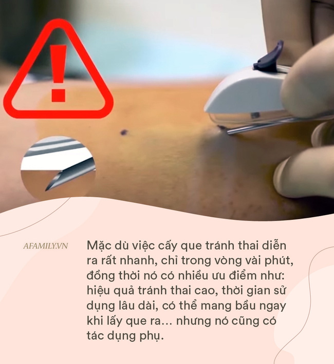 Cấy que tránh thai - tưởng không đau, hóa ra vẫn đau không tưởng-7