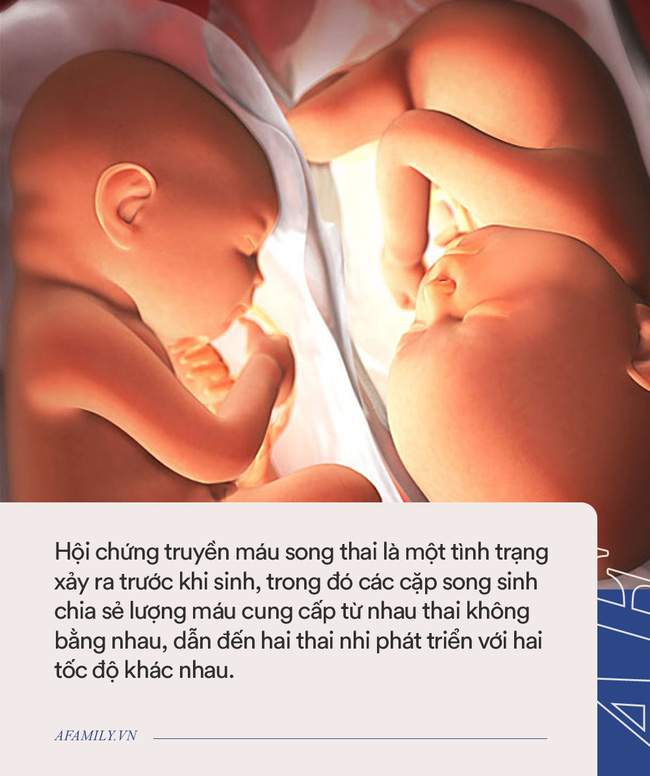 Chưa hết đau đớn vì con chết lưu, bà mẹ còn sốc khi bác sĩ yêu cầu giữ đứa trẻ đã mất trong bụng 10 tuần-8