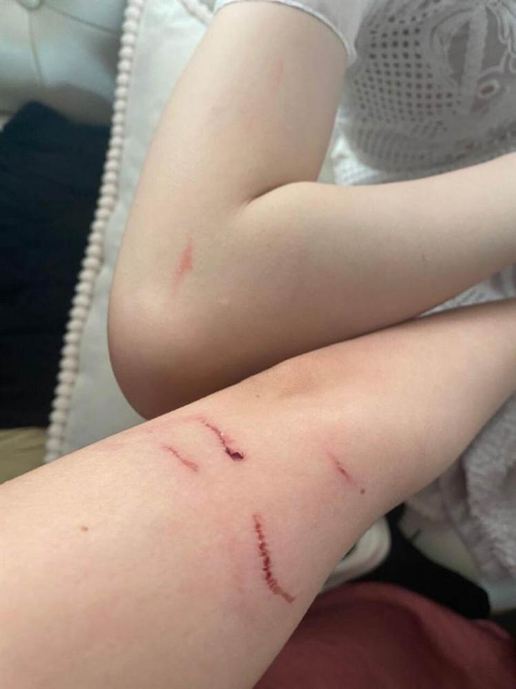 Hà Nội: Cãi vã vì mời rượu mà khách không uống, nhân viên quán bar xông vào đánh khách rách trán-1