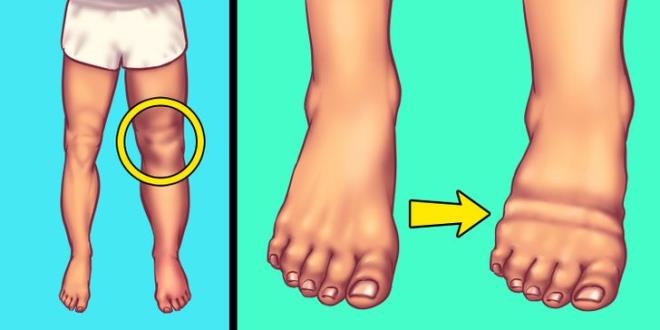 Dấu hiệu cảnh báo bạn đang ăn quá nhiều muối-1