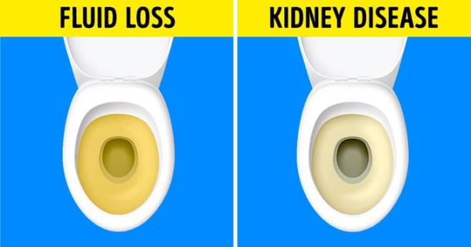 Dấu hiệu cảnh báo bạn đang ăn quá nhiều muối-3