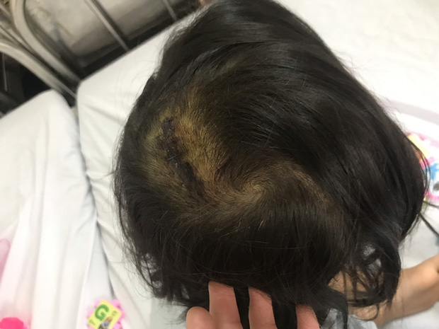 Vụ bố chồng dùng búa đánh con dâu và 2 cháu: Nguyên nhân ban đầu-2