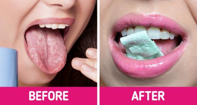 Mẹo chữa bỏng lưỡi khi ăn uống phải món nóng-4