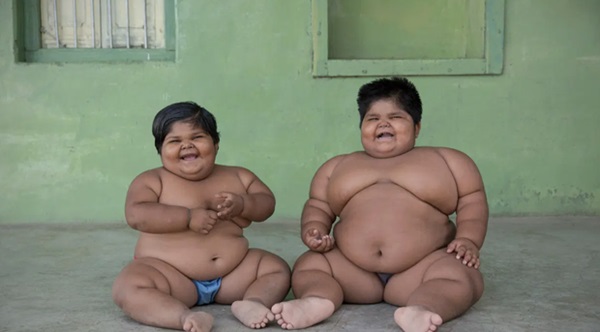 Gia đình nghèo có 3 con bị bệnh béo phì, bố đòi bán thận kiếm tiền cứu chữa từng thu hút sự chú ý của truyền thông thế giới giờ ra sao?-5