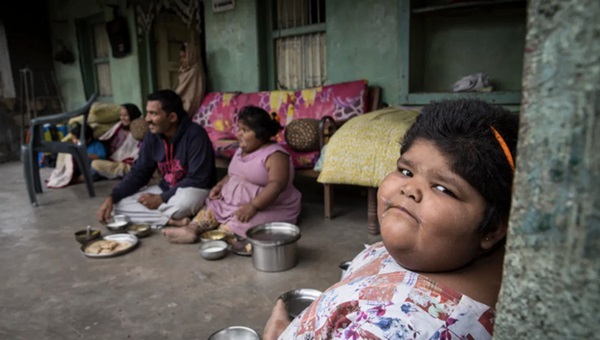 Gia đình nghèo có 3 con bị bệnh béo phì, bố đòi bán thận kiếm tiền cứu chữa từng thu hút sự chú ý của truyền thông thế giới giờ ra sao?-11