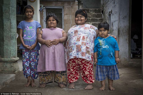 Gia đình nghèo có 3 con bị bệnh béo phì, bố đòi bán thận kiếm tiền cứu chữa từng thu hút sự chú ý của truyền thông thế giới giờ ra sao?-12