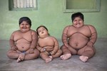 Cậu bé béo nhất thế giới nặng gần 200kg gây choáng với ngoại hình mới chỉ sau 4 năm giảm cân, nhìn hình không ai dám tin là cùng một người-11