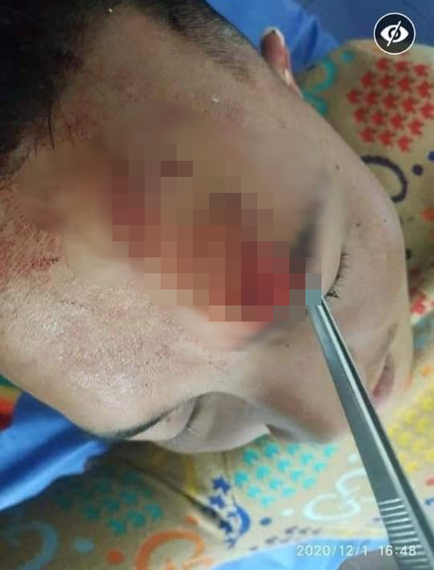 Xôn xao hình ảnh thánh nói đạo lý Huấn Hoa Hồng bị thương nặng ở đầu, phải nhập viện chụp chiếu nhưng tay vẫn không rời điện thoại-3