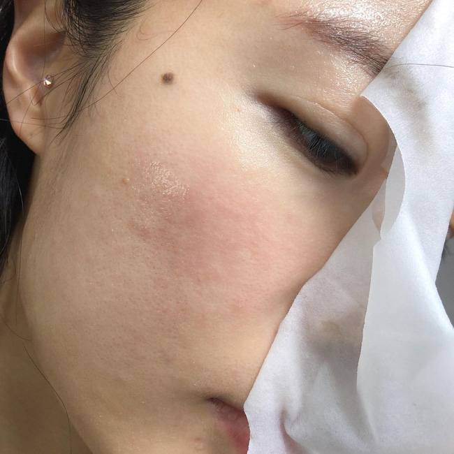 4 sản phẩm làm đẹp các bác sĩ cũng phải né tiệt, vì dùng sẽ rất hại da và còn đẩy nhanh tốc độ lão hóa-1