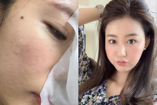 4 sản phẩm làm đẹp các bác sĩ cũng phải né tiệt, vì dùng sẽ rất hại da và còn đẩy nhanh tốc độ lão hóa