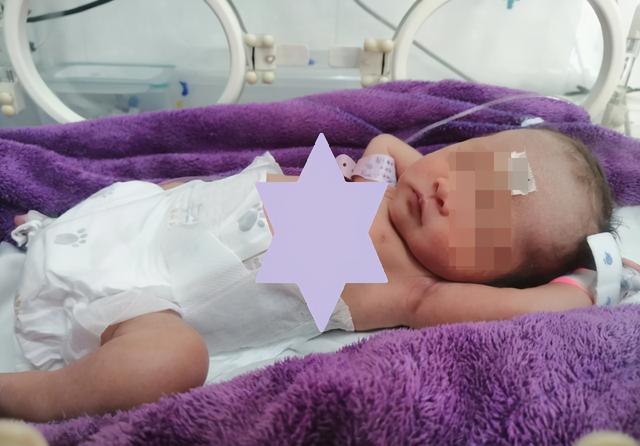 Bé chưa đầy tháng được thông báo bệnh nguy kịch vì chụp ảnh nghệ thuật, bác sĩ tức giận trách mắng người mẹ vô trách nhiệm”-2