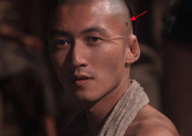 Tạ Đình Phong gây hoang mang khi lộ dấu hiệu của bệnh ung thư?-6