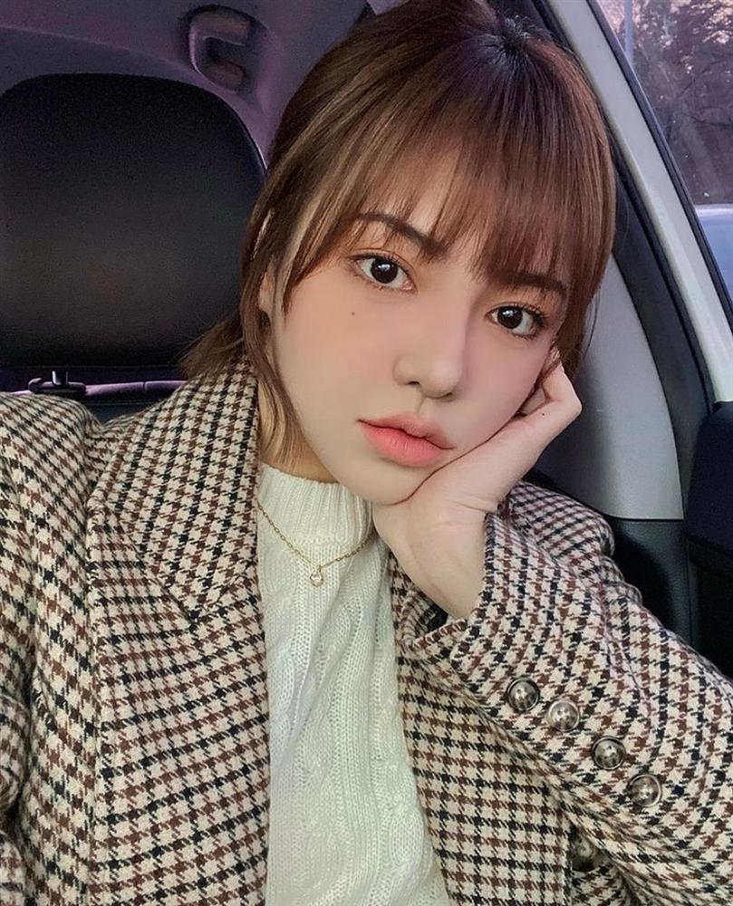 Mùa Đông môi dễ khô tróc, thâm xì nếu bạn không nhớ kỹ 6 tips dưỡng thần thánh này-1