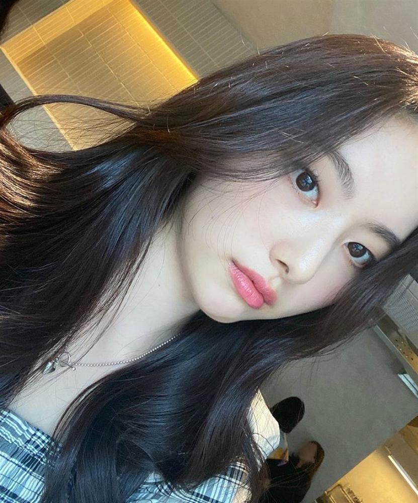 Mùa Đông môi dễ khô tróc, thâm xì nếu bạn không nhớ kỹ 6 tips dưỡng thần thánh này-5