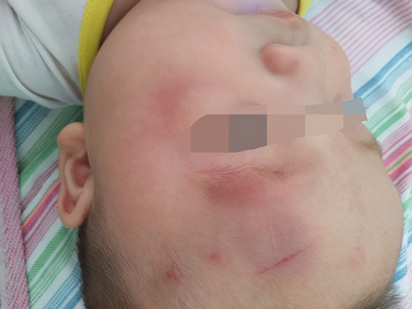 Sau khi con rơi ra khỏi giường, cha mẹ khôn ngoan sẽ không đỡ ngay lập tức! Điều quan trọng là phải hiểu mười giây vàng-4