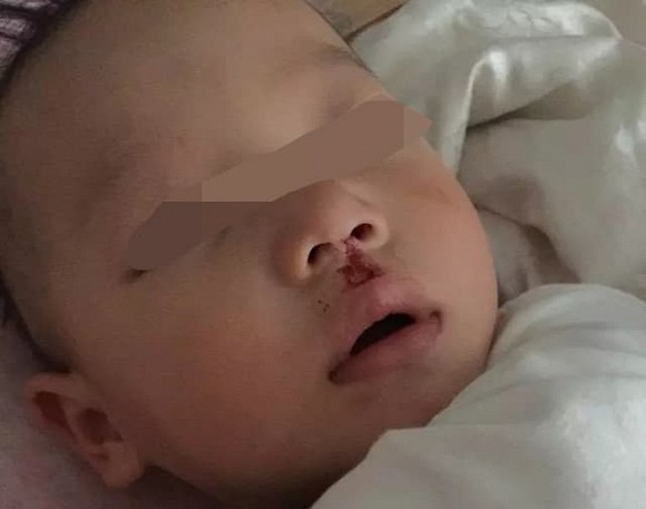 Sau khi con rơi ra khỏi giường, cha mẹ khôn ngoan sẽ không đỡ ngay lập tức! Điều quan trọng là phải hiểu mười giây vàng-6