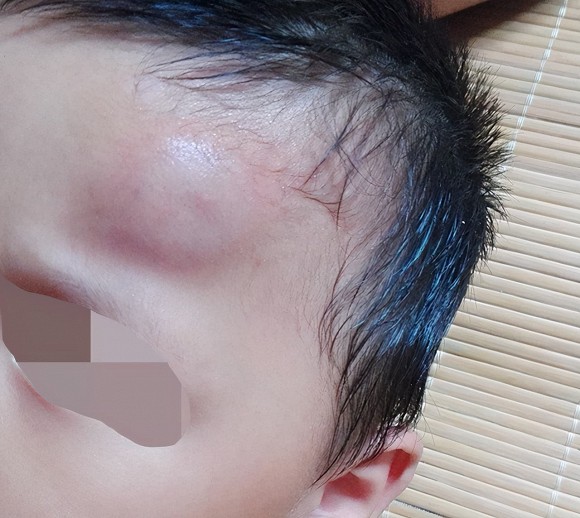 Sau khi con rơi ra khỏi giường, cha mẹ khôn ngoan sẽ không đỡ ngay lập tức! Điều quan trọng là phải hiểu mười giây vàng-7