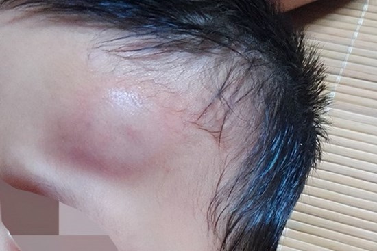 Sau khi con rơi ra khỏi giường, cha mẹ khôn ngoan sẽ không đỡ ngay lập tức! Điều quan trọng là phải hiểu 'mười giây vàng'