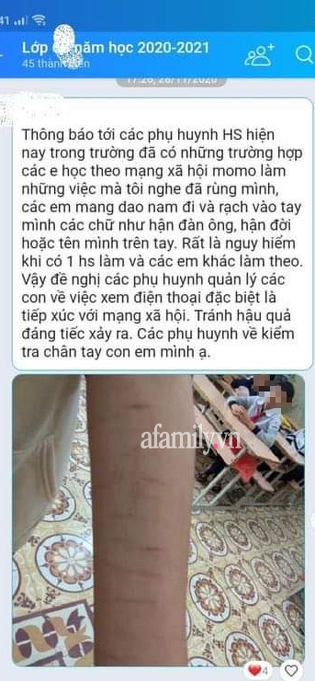 Cảnh báo: Xôn xao tình trạng nhiều học sinh dùng dao lam tự rạch tay chân, có em rạch đến 27 vết, nghi học theo trên Youtube-4