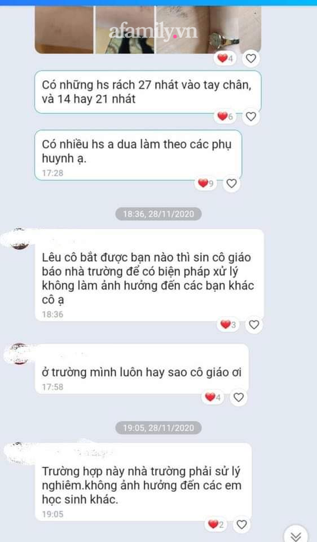 Cảnh báo: Xôn xao tình trạng nhiều học sinh dùng dao lam tự rạch tay chân, có em rạch đến 27 vết, nghi học theo trên Youtube-5