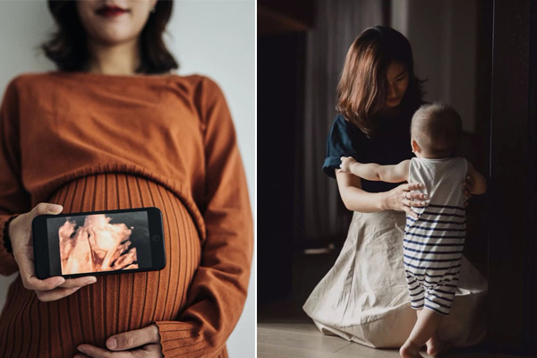 Cậu bé mặt chim” sinh ra mới chưa đầy 2 ngày đã bị bố mẹ bỏ rơi vì quá xấu xí gây bất ngờ với cuộc sống hiện tại bên bạn đời xinh đẹp-9