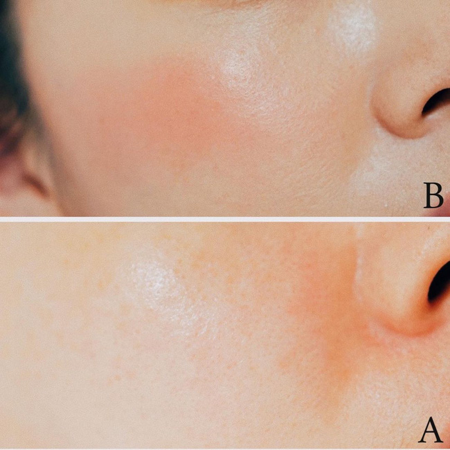 Bác sĩ bật mí 5 mẹo rửa mặt cho da sạch đến từng lỗ chân lông, theo thời gian da càng thêm tươi sáng mịn màng-3