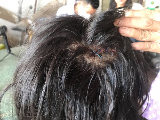 Nữ sinh bị đánh bầm dập sau va chạm giao thông: Em không nghĩ mình bị đánh nhiều đến vậy, sờ lên mặt đầy máu”-3