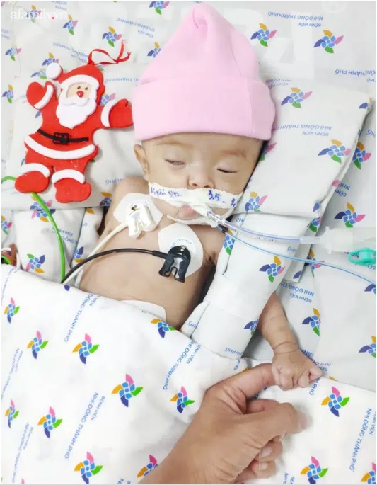 Vừa về nhà sau sinh, bé gái đã bị sặc sữa nguy kịch: Bác sĩ khuyến cáo các mẹ học ngay cách xử lý này-1