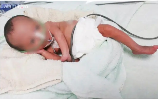 Vừa về nhà sau sinh, bé gái đã bị sặc sữa nguy kịch: Bác sĩ khuyến cáo các mẹ học ngay cách xử lý này-2