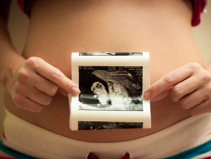 Sảy thai không phải là không có dấu hiệu báo trước, mẹ bầu có 3 dấu hiệu này cần chú ý-3