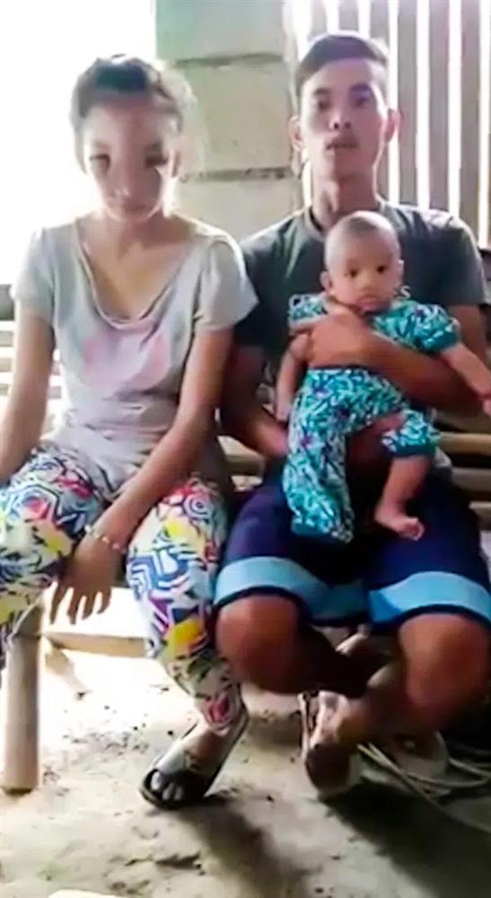 Thiếu nữ 17 tuổi bị biến dạng khuôn mặt sắp mù chỉ vì một hành động vô tư nhiều người vẫn làm, dáng vẻ trước khi gặp họa càng gây xót xa-3