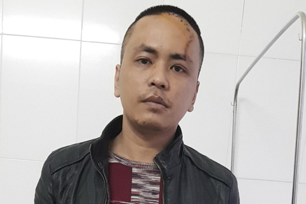 Thông tin bất ngờ nghi án 4 ngư phủ bị chém, đẩy xuống biển ở Cà Mau: Tất cả chỉ là ảo giác?-2