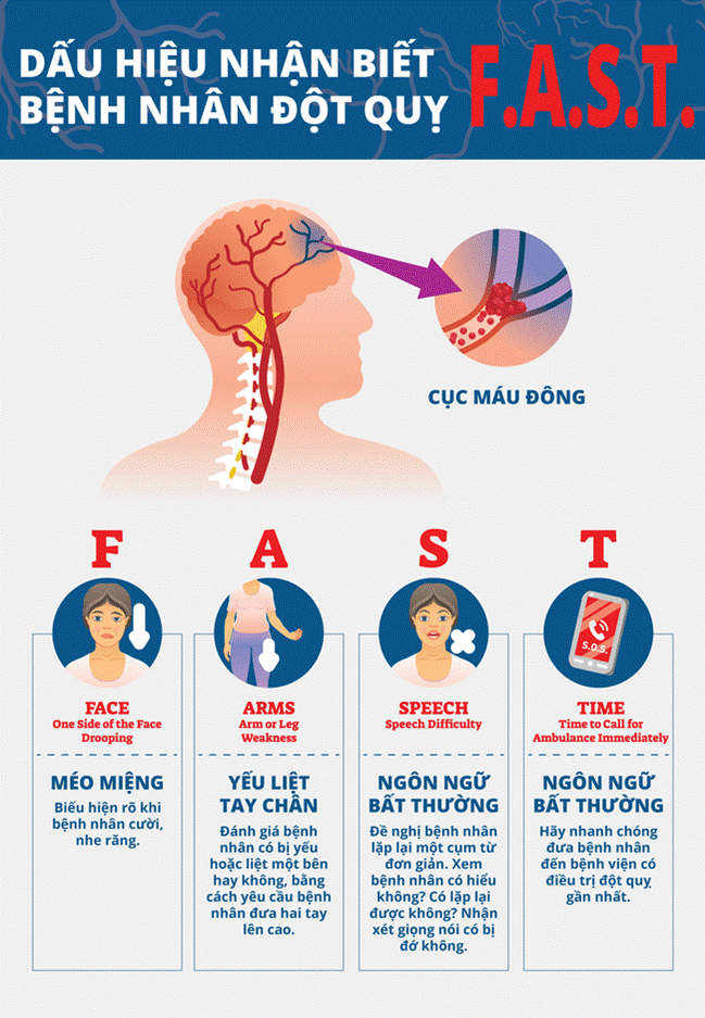 Trước nghệ sĩ Chí Tài, những sao nam này cũng đã qua đời vì đột quỵ: Cảnh báo nhóm người có nguy cơ cao hơn, tuyệt đối không chủ quan-5