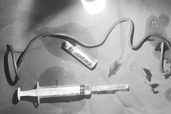 Nam thanh niên Hà Nội nhập viện do bị pin con thỏ chui vào đại trực tràng-1