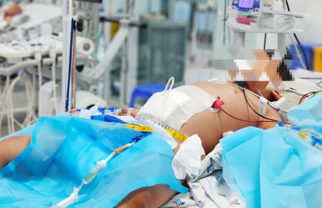 Bé trai nguy kịch tính mạng sau 3 ngày sốt cao-1