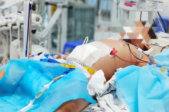 Bé trai nguy kịch tính mạng sau 3 ngày sốt cao